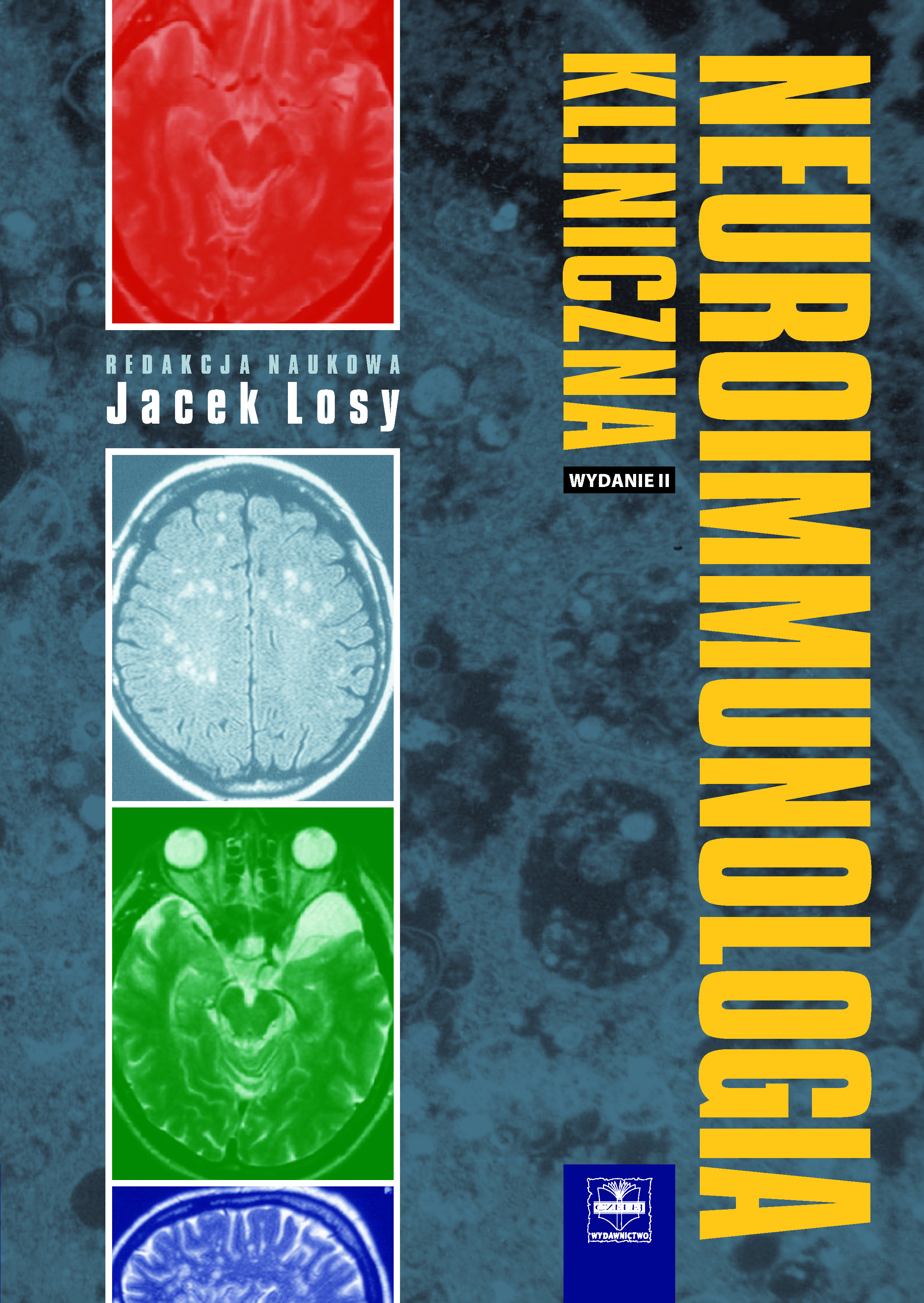 neuroimmunologia