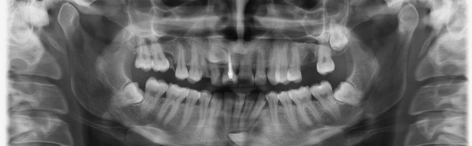 Mały atlas radiologiczny