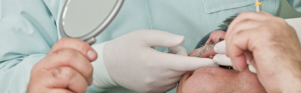 Leczenie endodontyczne drugiego zęba trzonowego szczęki z pojedynczym korzeniem i pojedynczym kanałem korzeniowym