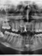 Mały atlas radiologiczny